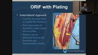 Humeral Shaft Fractures  John Callaghan MD [upl. by Elin930]