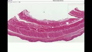 Anatomy  Histology of the Esophagus [upl. by Notsuj]