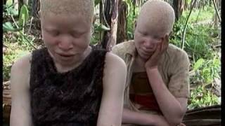 Deadly Hunt Albinos in Tanzania [upl. by Punke398]